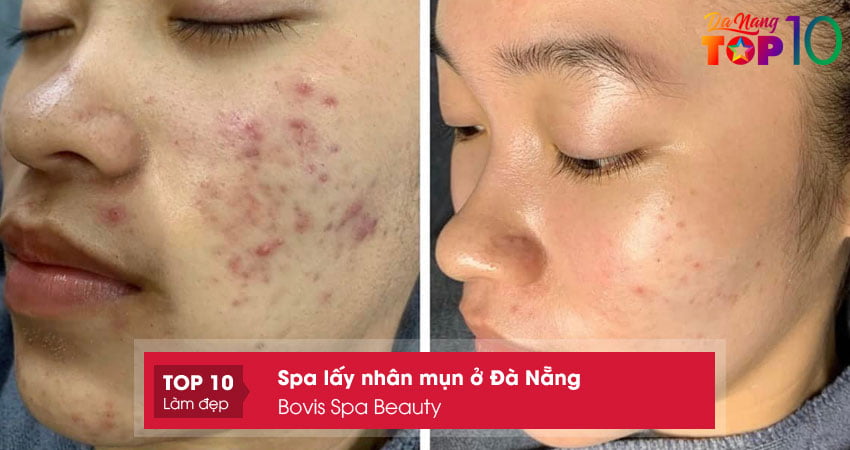 bovis-spa-beauty-top10danang