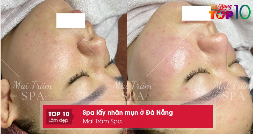 mai-tram-spa-top10danang