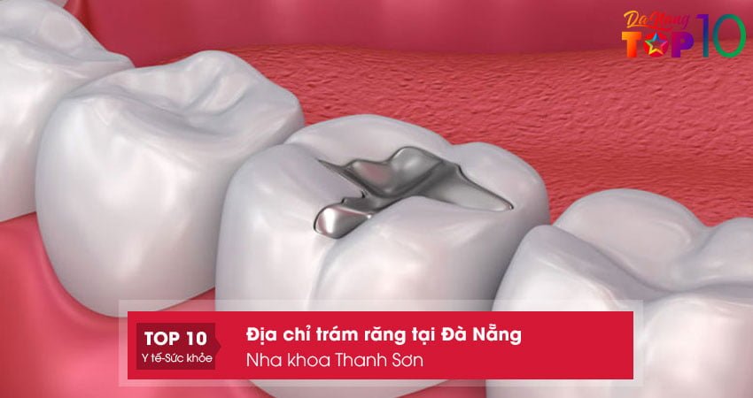 nha-khoa-thanh-son-top10danang