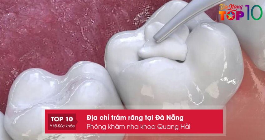 phong-kham-nha-khoa-quang-hai-tram-rang-tai-da-nang-uy-tin-top10danang