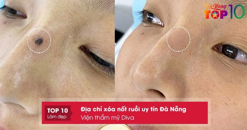 vien-tham-my-diva-top10danang