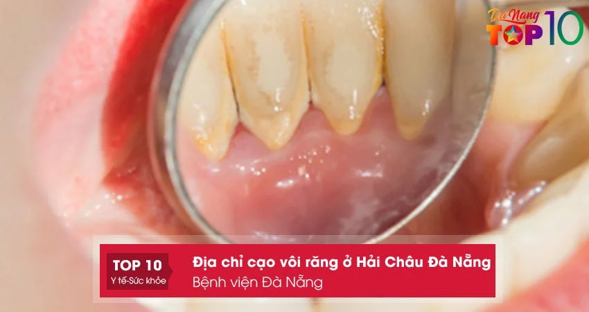 benh-vien-da-nang1-top10danang