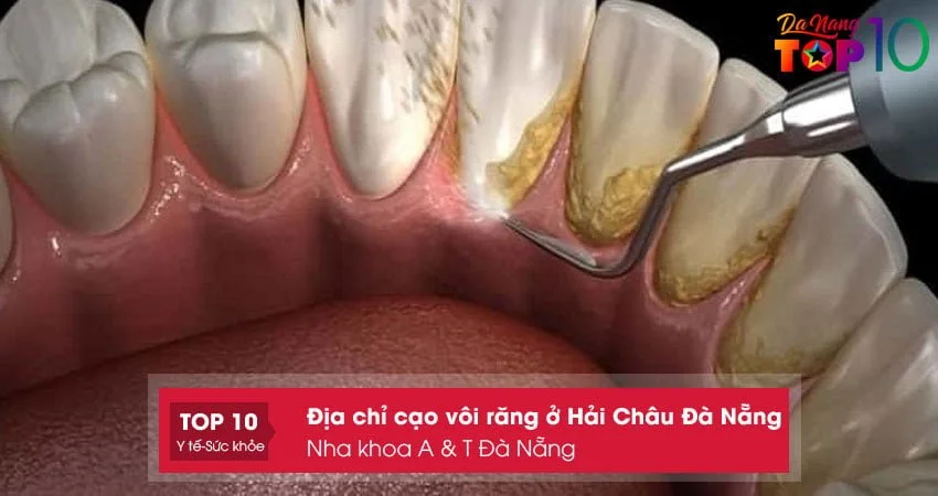 nha-khoa-a-t-da-nang-top10danang