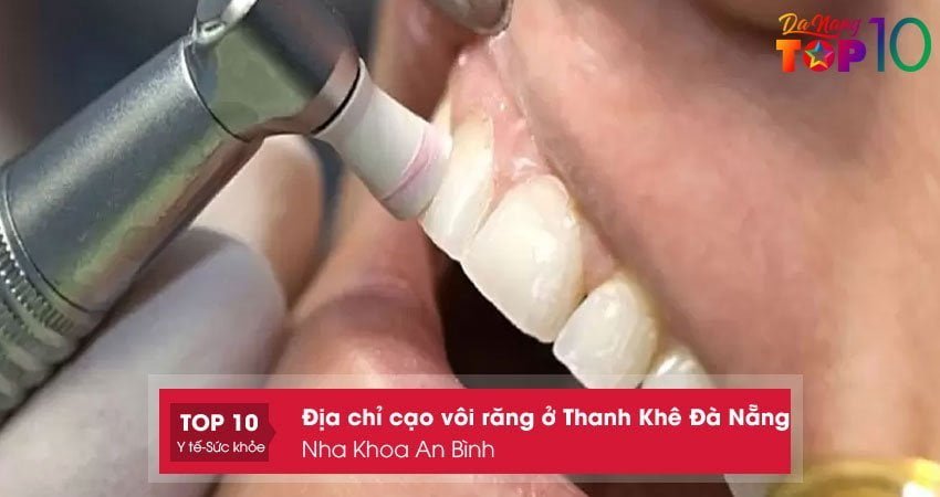 nha-khoa-an-binh-top10danang