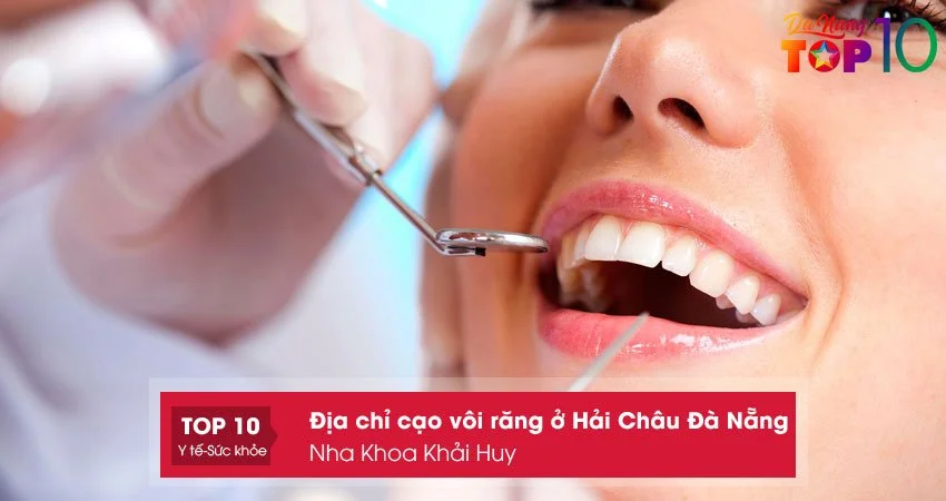 nha-khoa-khai-huy-cao-voi-rang-o-hai-chau-da-nang-gia-tot-top10danang