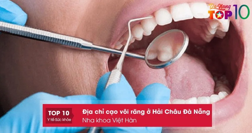 nha-khoa-viet-han-cao-voi-rang-o-hai-chau-da-nang-an-toan-nhat-top10danang