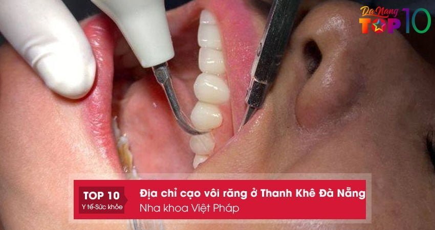 nha-khoa-viet-phap-top10danang