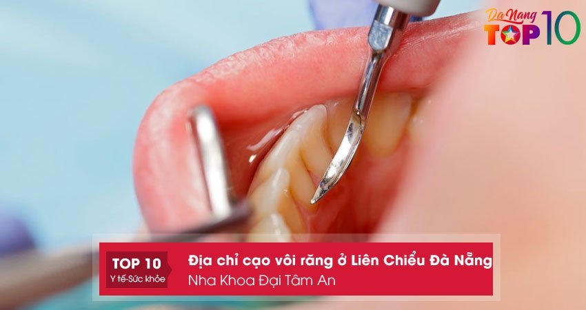 nha-khoa-dai-tam-an-dia-chi-cao-voi-rang-o-lien-chieu-da-nang-top10danang