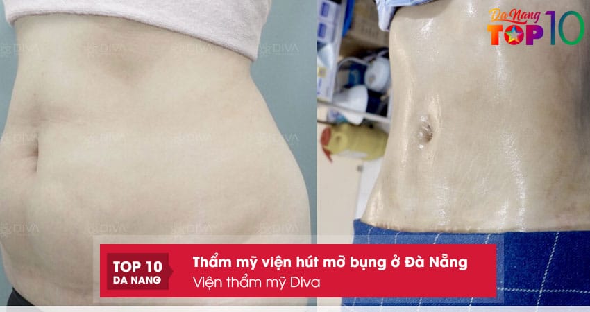 Vien-tham-my-diva-top10danang