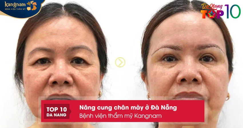 Benh-vien-tham-my-kangnam-top10danang