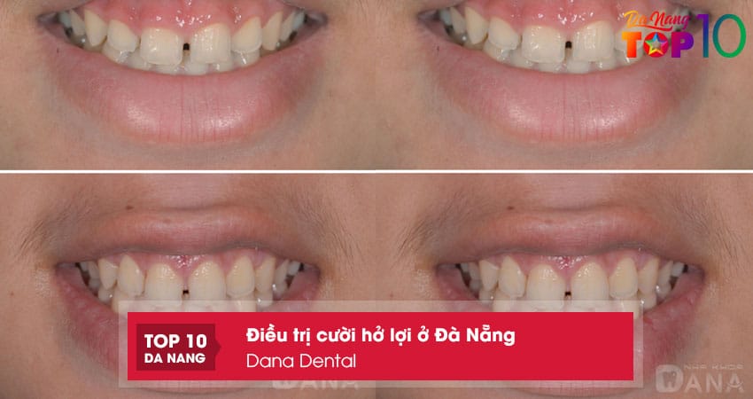 Dana-dental-top10danang