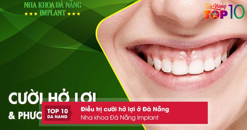 Nha-khoa-da-nang-implant-top10danang
