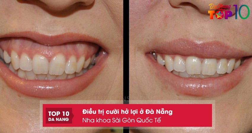 Nha-khoa-sai-gon-quoc-te-top10danang