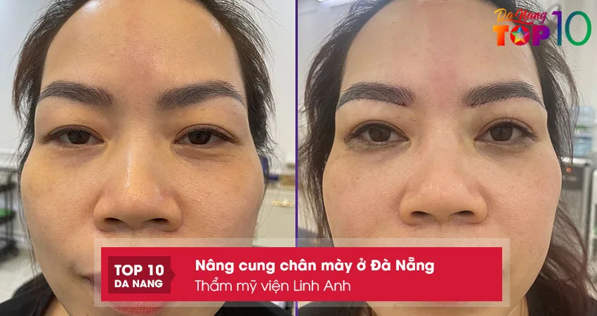 Tham-my-vien-linh-anh-top10danang