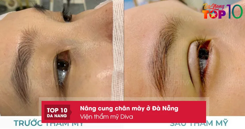 Vien-tham-my-diva-top10danang