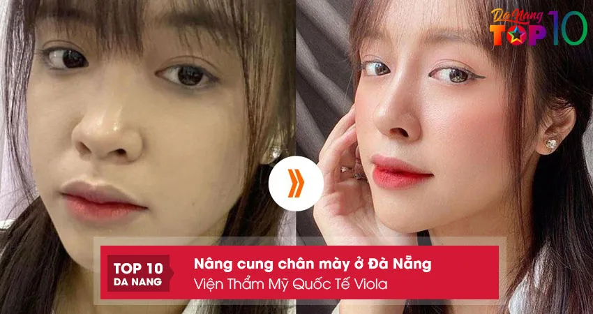 Vien-tham-my-quoc-te-viola-top10danang