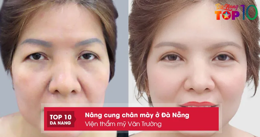 Vien-tham-my-van-truong-top10danang