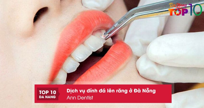 Ann-dentist-top10danang