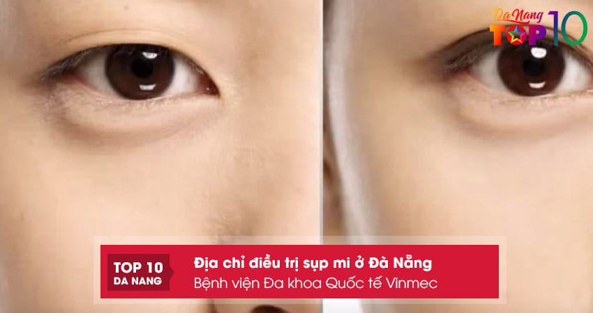 Benh-vien-da-khoa-quoc-te-vinmectop10danang