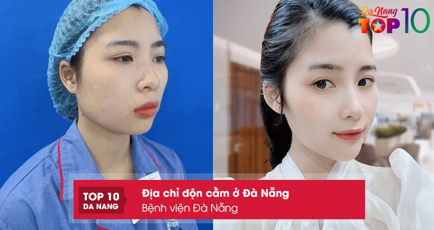 Benh-vien-da-nang-top10danang