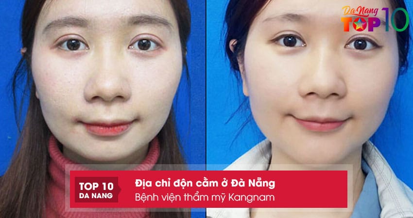 Benh-vien-tham-my-kangnam-top10danang