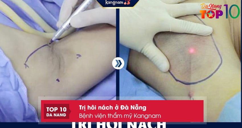 Benh-vien-tham-my-kangnam-top10danang