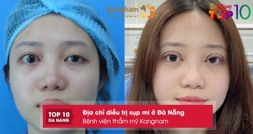 Benh-vien-tham-my-kangnam-top10danang