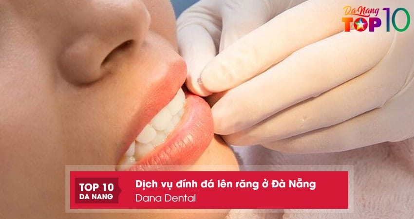 Dana-dental-top10danang