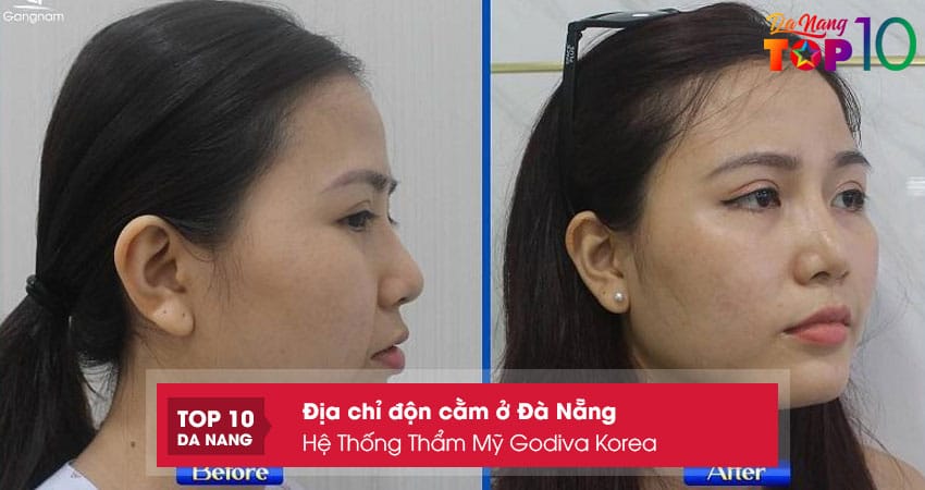 He-thong-tham-my-godiva-korea-top10danang
