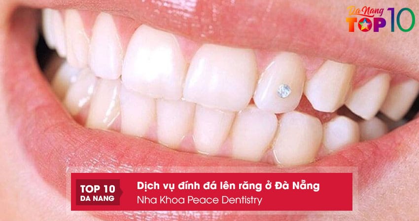 Nha-khoa-paris-top10danang