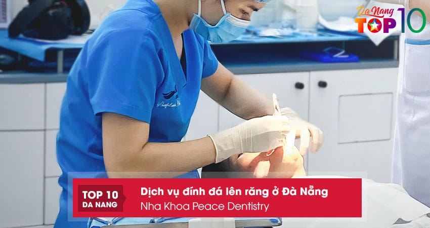 Nha-khoa-peace-dentistry-top10danang