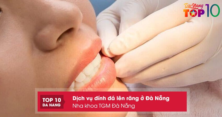 Nha-khoa-tgm-da-nang-top10danang