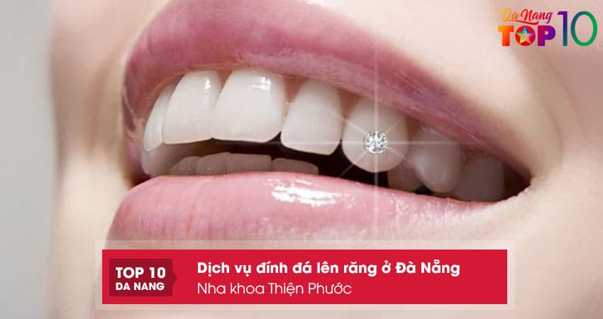 Nha-khoa-thien-phuoc-top10danang
