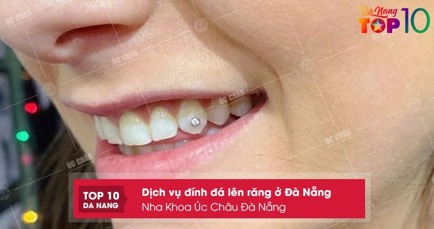Nha-khoa-uc-chau-da-nang-top10danang