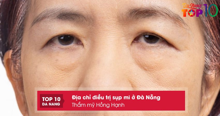 Tham-my-hong-hanh-top10danang