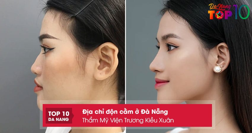 Tham-my-vien-truong-kieu-xuan-top10danang