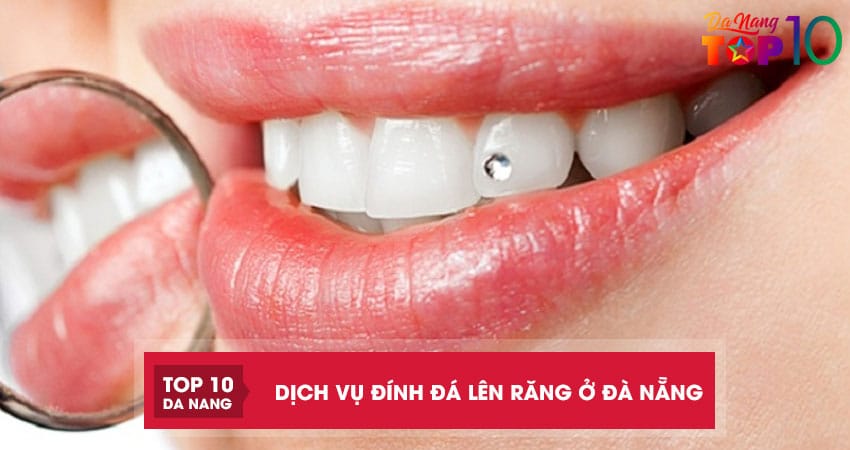 Top-10-noi-cung-cap-dich-vu-dinh-da-len-rang-o-da-nang-tham-my-top10danang