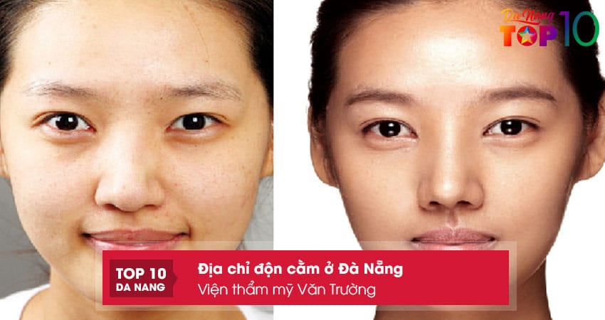 Vien-tham-my-van-truong-top10danang
