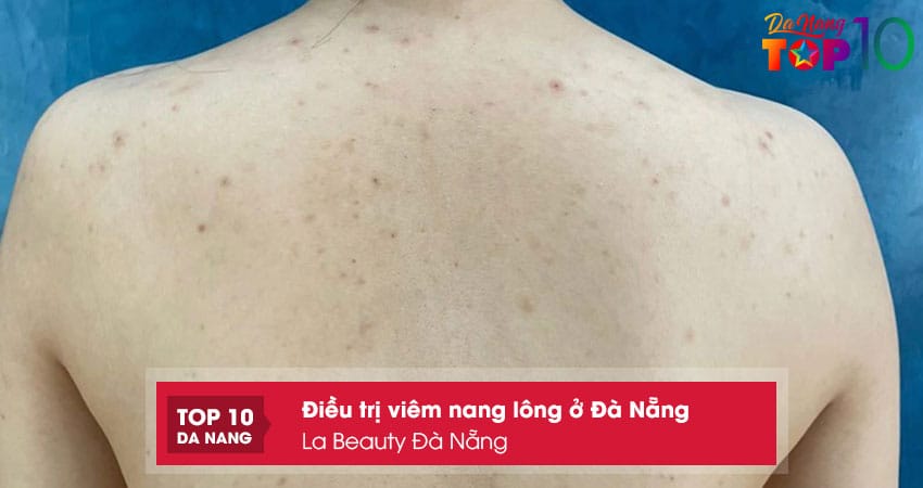 La-beauty-da-nang-top10danang