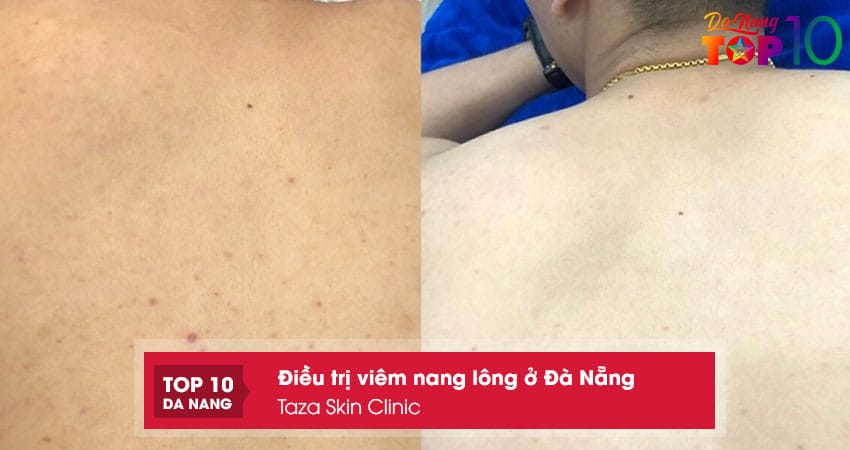 Taza-skin-clinic-top10danang