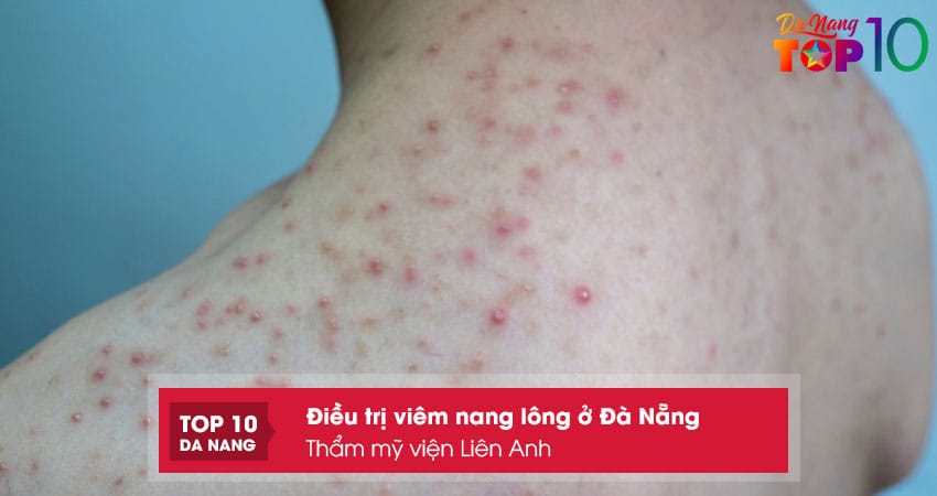 Tham-my-vien-lien-anh-top10danang