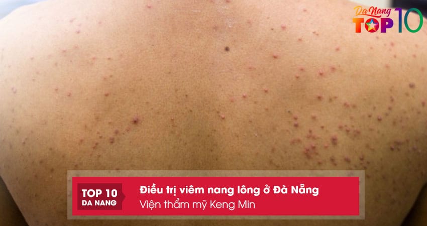 Vien-tham-my-keng-min-top10danang