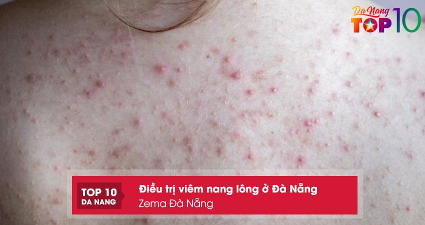 Zema-spa-top10danang