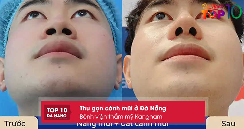 Benh-vien-tham-my-kangnam-top10danang