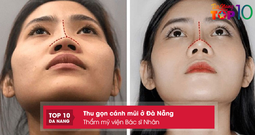 Tham-my-vien-bac-si-nhan-top10danang