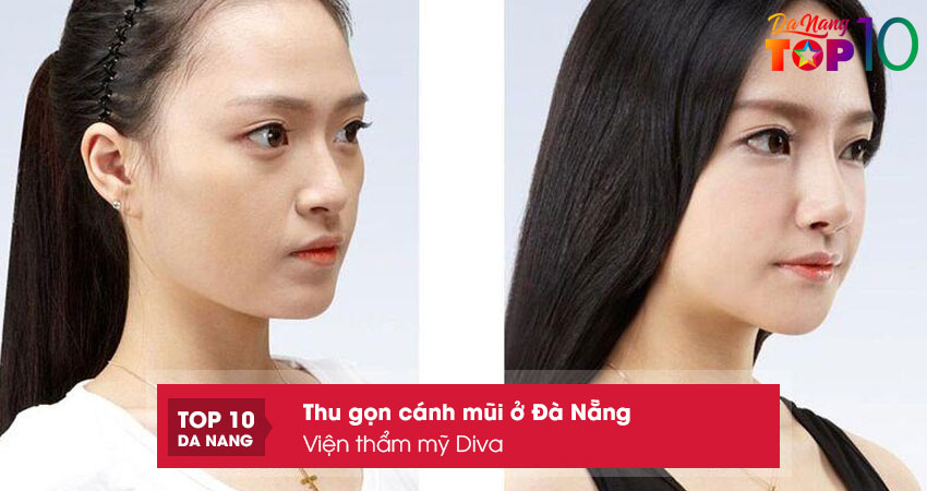Vien-tham-my-diva-top10danang