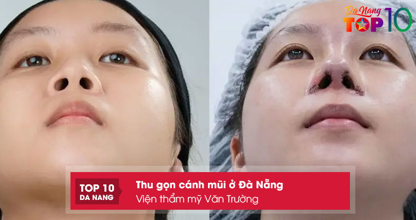 Vien-tham-my-van-truong-top10danang