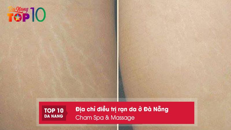 Cham-spa-massage-top10danang