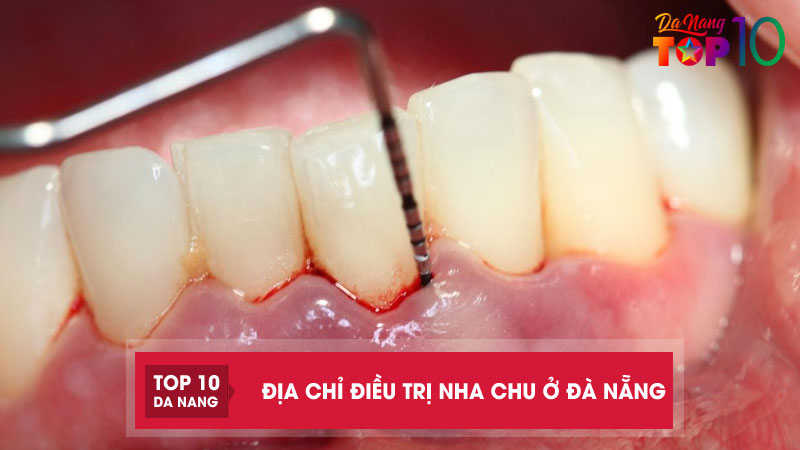 Dia-chi-dieu-tri-nha-chu-o-da-nang-top10danang
