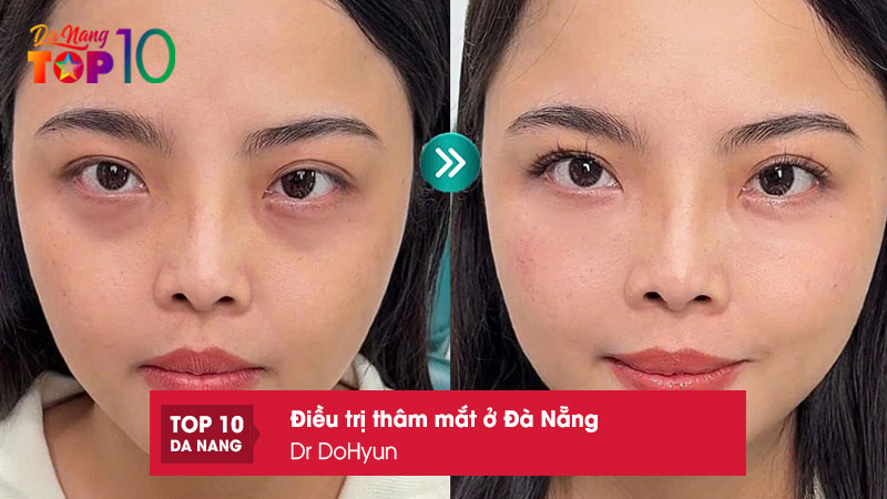 Dr-dohyun-top10danang